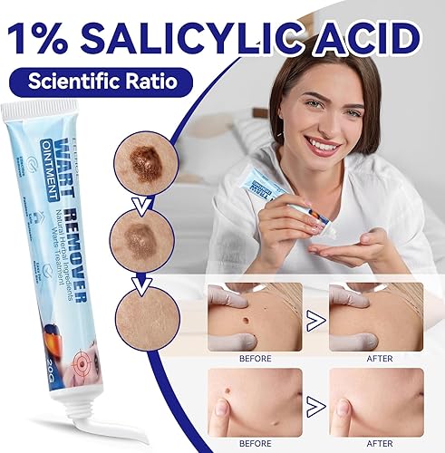 Miniatura 2 de Crema eliminadora de verrugas genitales, ungüento de verrugas de acción rápida con máxima resistencia para uso doméstico, seguro y eficaz (3 tubos-04