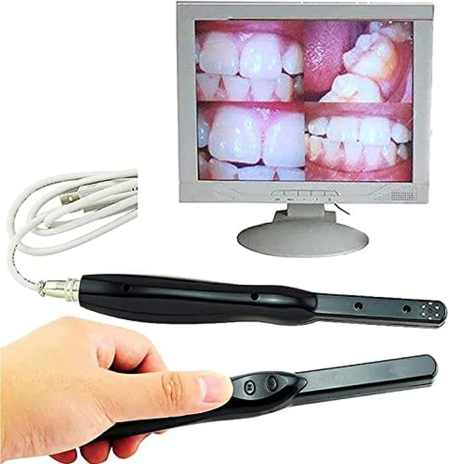 Caméra Intra-orale Dentaire KRASS, 6 Mégapixels, USB, Noir, Résistant à l'eau, Pour Inspection Orale des Individus et Animaux Domestiques, Dents Orthodontiques
