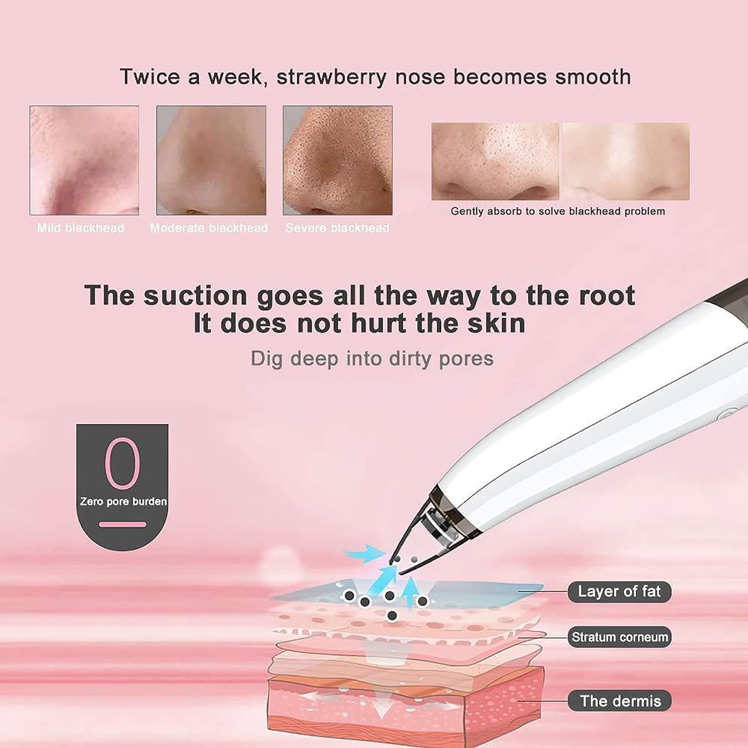 Aspirateur de pores for enlever les points noirs – Extracteur de boutons de nettoyage du visage, outil d'aspiration de points noirs, nettoyeur de pores du visage, outil d'extraction de points b