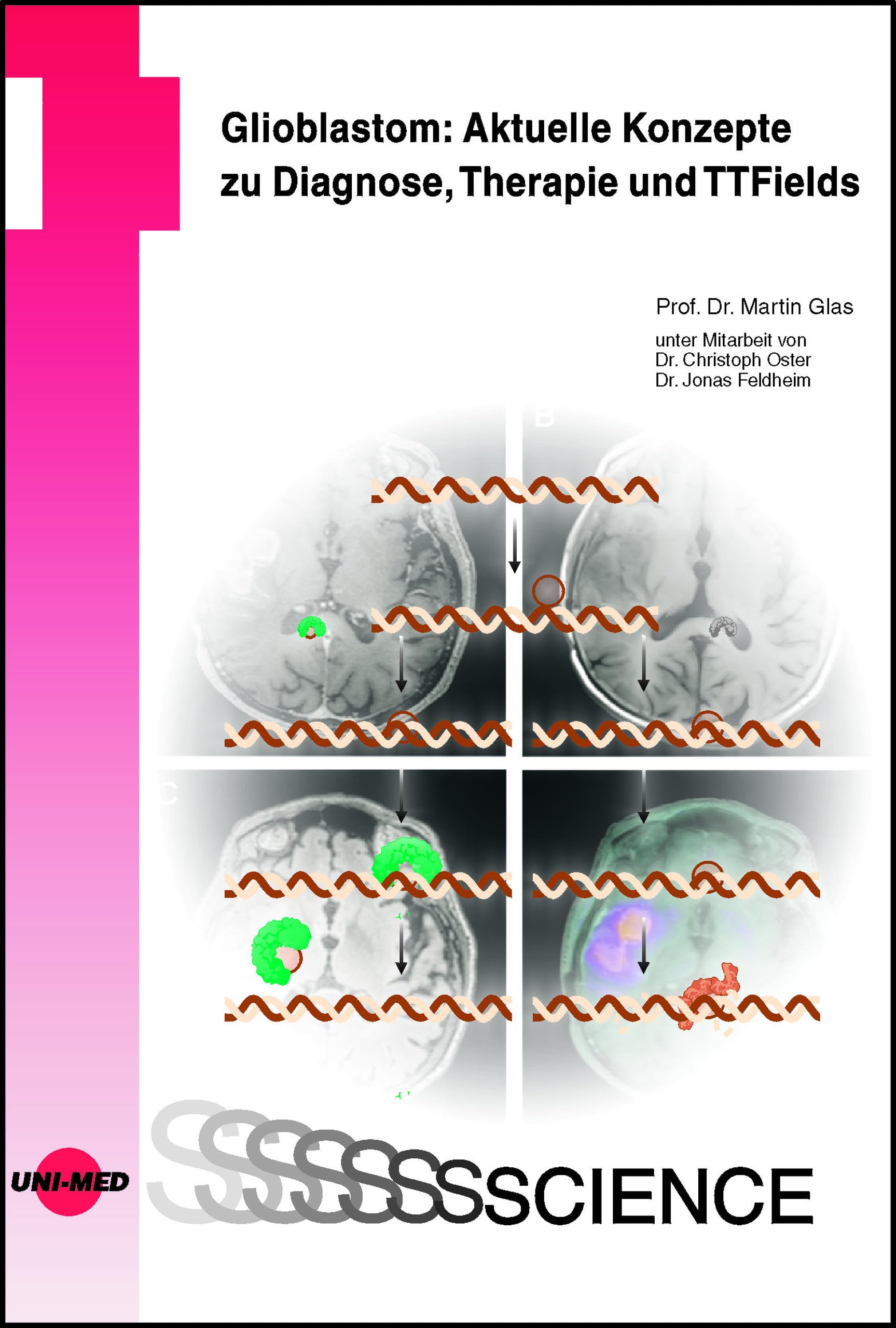 Glioblastom: Aktuelle Konzepte zu Diagnose, Therapie und TTFields (UNI-MED Science)