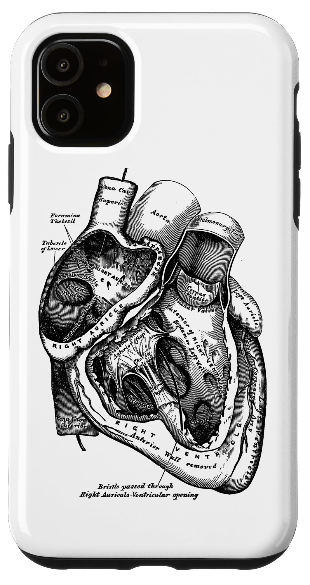 IPhone 15 Hülle Mit Anatomischem Herz-Motiv – Cooles Med-Design Für Studenten & Pflegekräfte