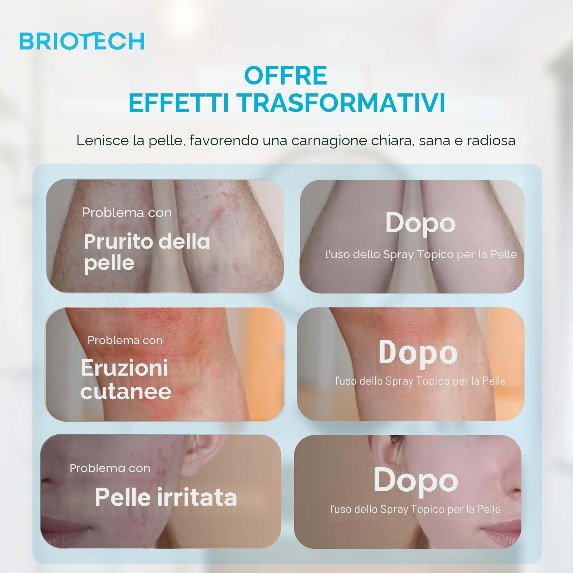 BRIOTECH Topical Skin Spray - Spray lenitivo per il corpo, per pelle irritata, cuoio capelluto, prurito, eruzione cutanea, scottature, spray idratante, spray per piercing, 100 ml