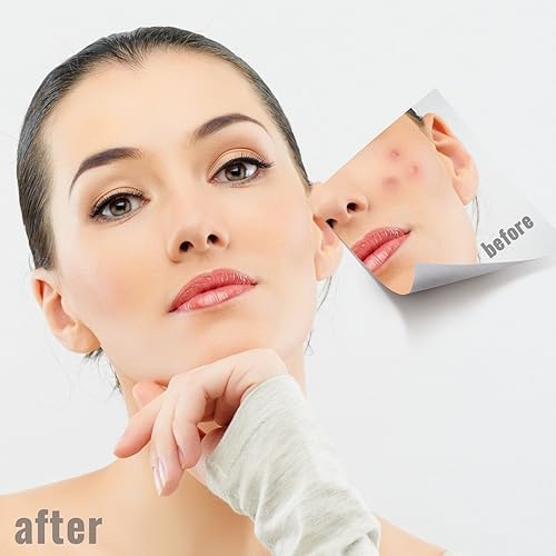 Miniatura 3 de Kit de herramientas para eliminar manchas de puntos negros, kit de herramientas extractoras de acné de acero inoxidable, juego de 5 instrumentos