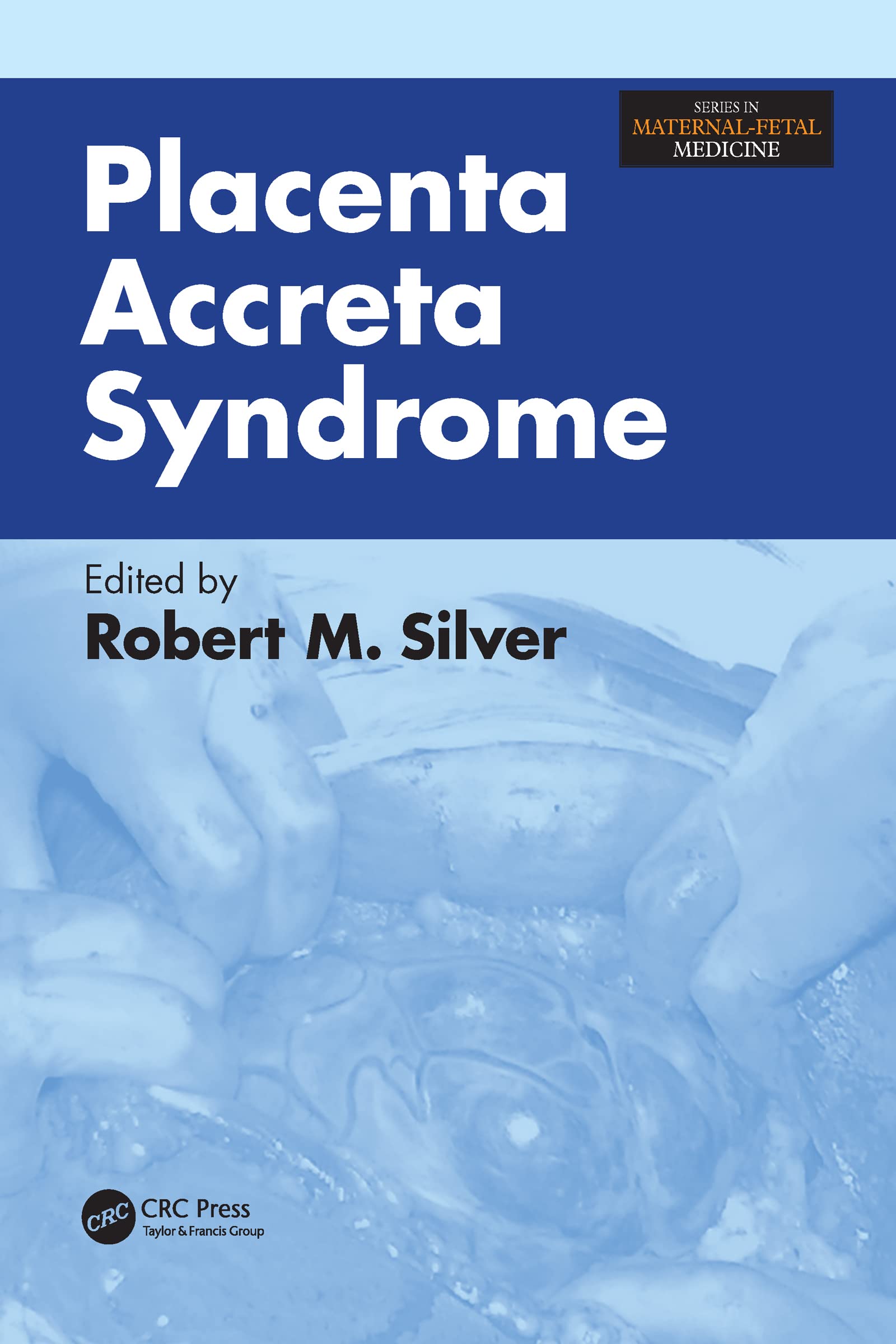 Placenta Accreta Syndrome Manuel de Médecine Fœto-Maternelle