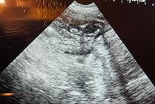 Review Image by Dawn Dawn