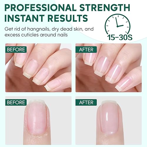 Miniatura 11 de Kit removedor de cutículas, crema removedor de cutículas de 6.09 onzas con recortador de cutículas, pinza de cutícula, empujador de cutículas, lápiz