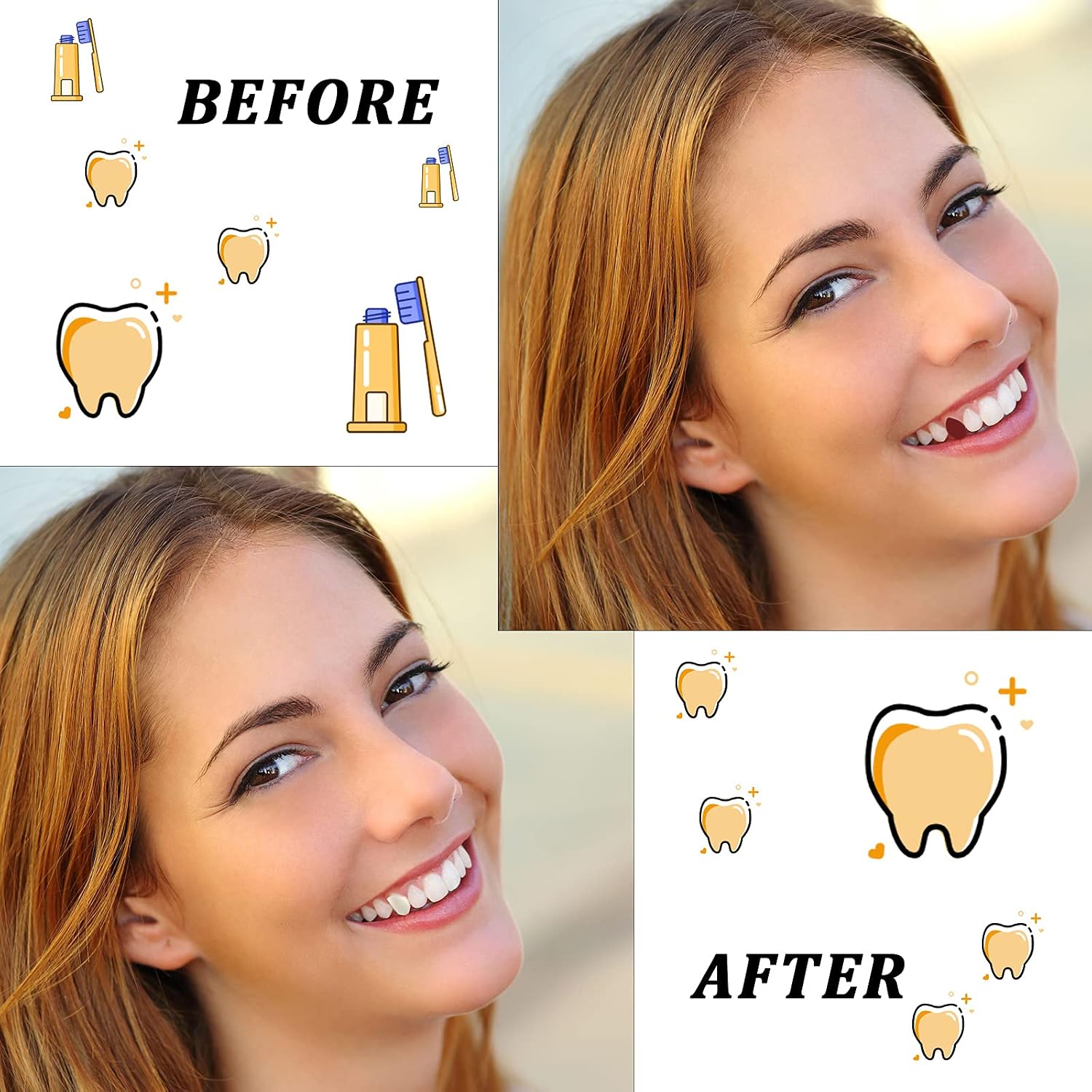 Resin Teeth Veneers Mixed Dental Temporary Teeth Front and Molar Posterior Teeth for Halloween Cosplay Party Makeup Scary Theme Party Costume Filling Fix Missing Broken Tooth (200 Pieces)