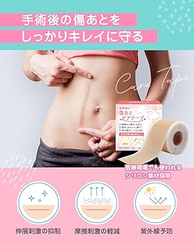 クリニセルS 傷あとケア（火傷 ケガ 手術あと 帝王切開あと） クリニセルS 傷あとケア（火傷 ケガ 手術あと 帝王切開あと