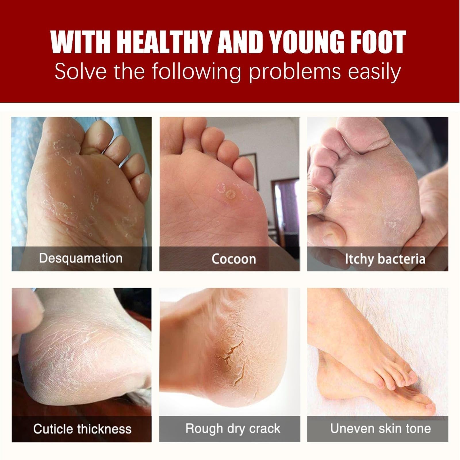Máscara de pie para peeling de melocotón, máscara de pies hidratante con nueces de coco- Cuidado de callos y pieles muertas - Pie Hidratante, exfoliante, callo peeling pies