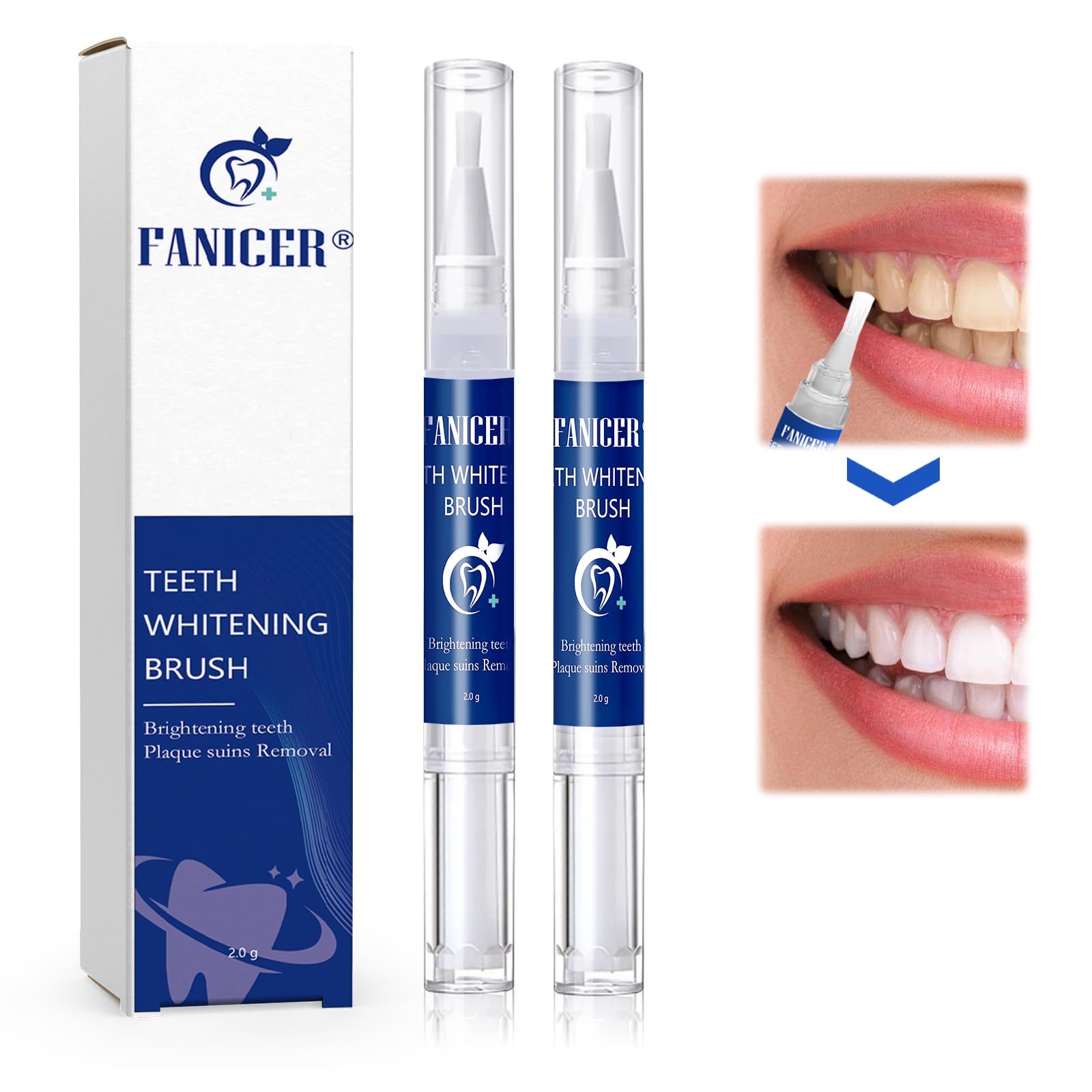 Lapiz Blanqueador Dental, 2 Piezas Gel Blanqueador de Dientes, Profesional Blanqueamiento Dental Efectivo, Sin Sensibilidad Eliminar Las Manchas Dentales
