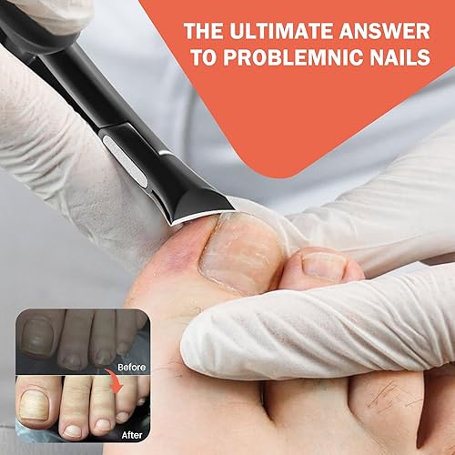 Miniatura 2 de BEZOX Cortaúñas gruesas para personas mayores, cortaúñas gruesas de precisión para hombres y mujeres, cortaúñas de agarre cómodo, cortador de uñas