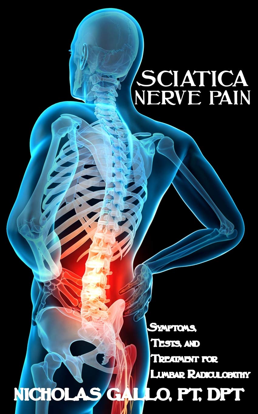 Buy Sciatica Nerve Pain Symptoms, Tests, and s for Lumbar