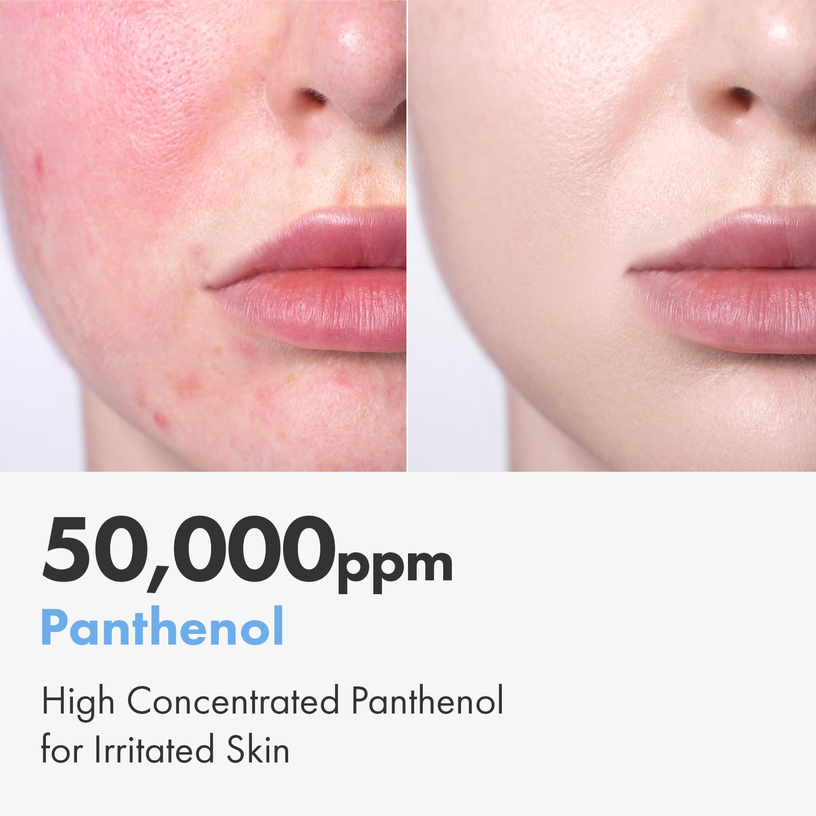 NATUREKIND Cica Panthenol Cream, 50,000 ppm Pantenol, Centella Asiática y Ácido Hialurónico, Hidratante Reparador Barrera para Piel Seca y Sensible, Cuidado de la Piel Coreano, 150 g