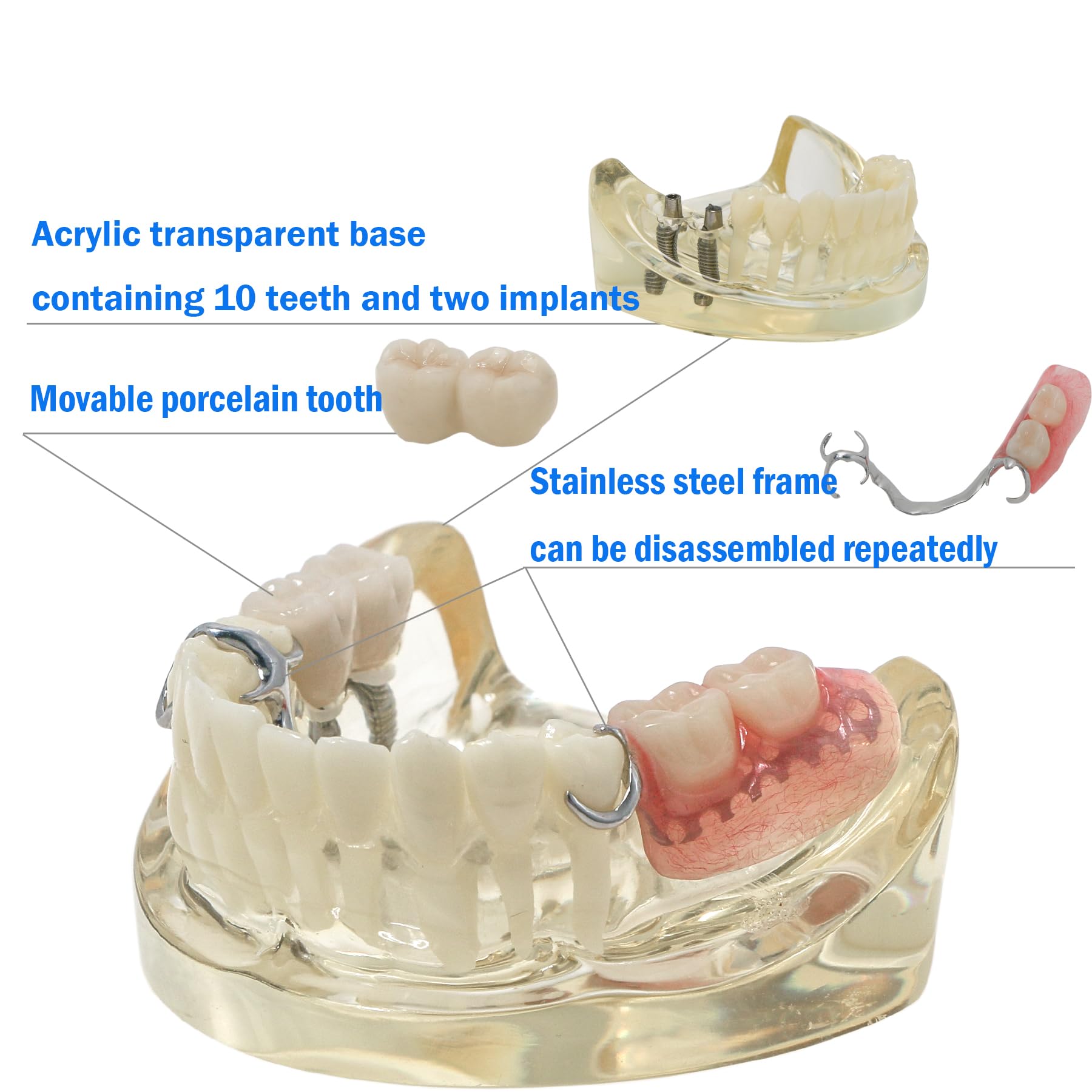 Dental RPD Removable Partial dentures Model Typodont lmplant Model