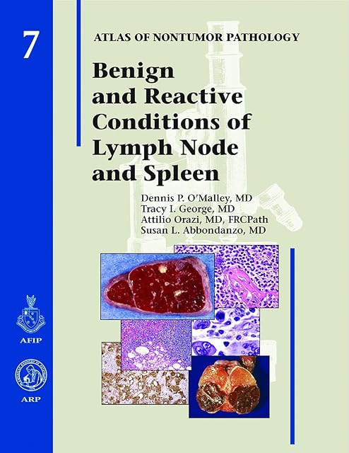 Portada de Benign And Reactive Conditions Of Lymph Node And Spleen