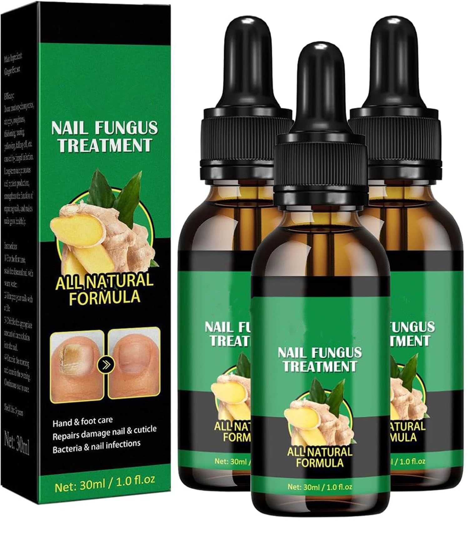 Ginger Nail Treatment Nail Support Nail Care, NailTreatment,Ginger NailGrowth Serum, Ginger NailTreatment, Ginger Cuticle Care Oil for DamagedNails (3pcs, 30ml)
