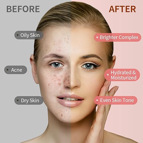 Miniatura 3 de Máscara de gelatina en polvo para piel facial, máscara facial de pétalos de rosa naturales, mascarilla profesional de hidrogelina, hidratante,