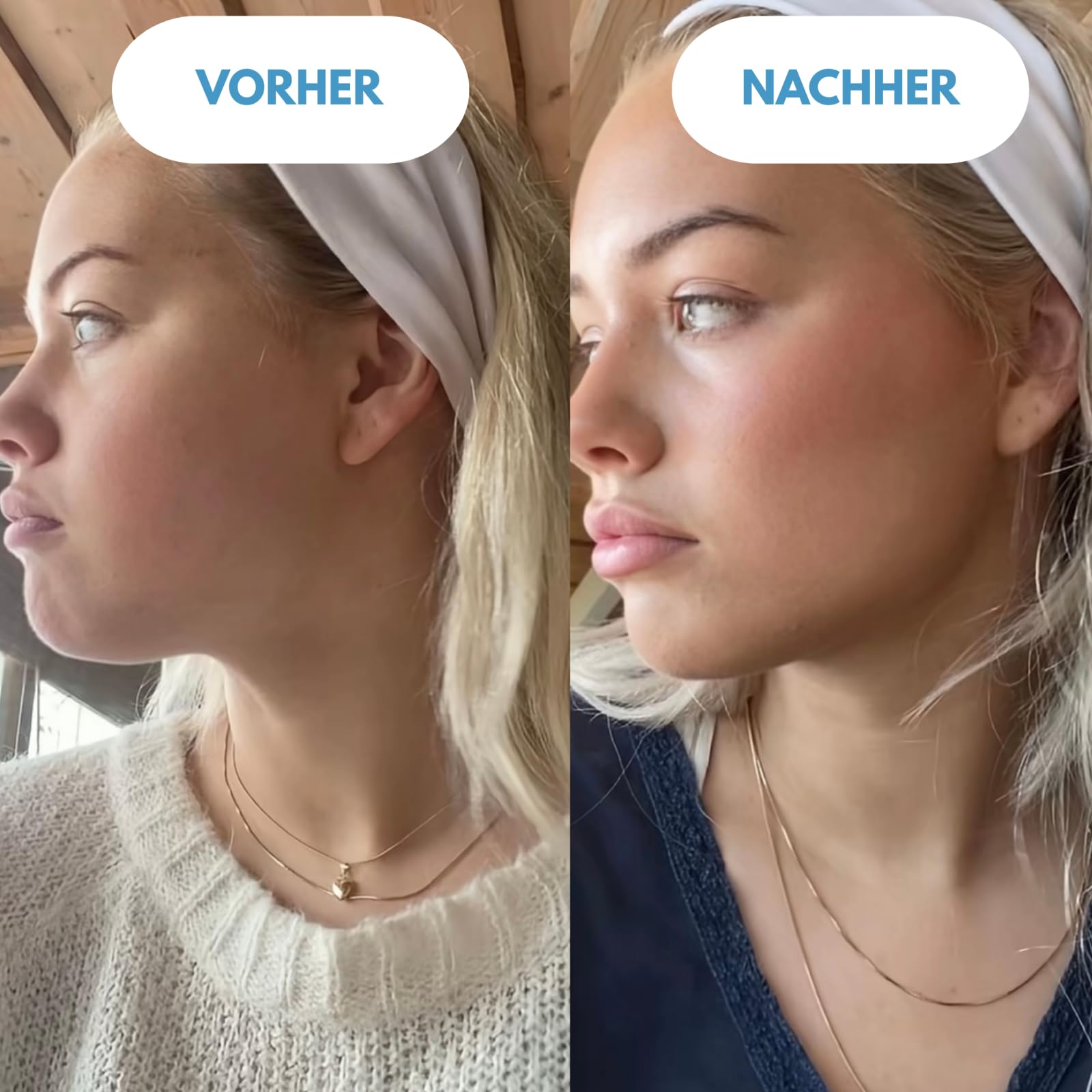 clear & lift,Gesichtsmassagegerät, 7 LED Lichtmodelle & 45°C Konstante Erwärmung, EMS Elektrisch V Shape Facial Lift, Gua Sha Face Massager