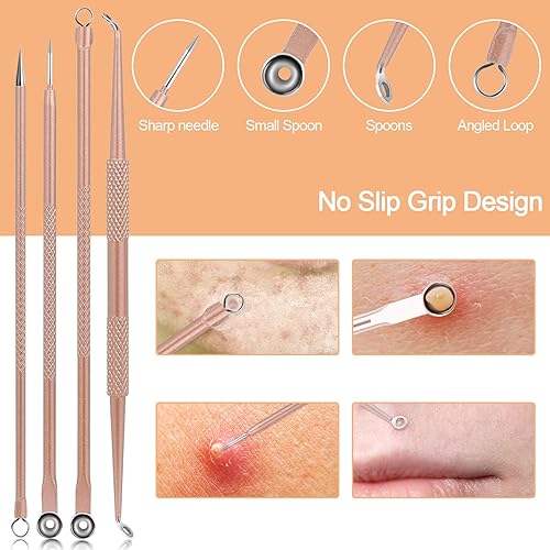 Miniatura 10 de Kit de herramientas para eliminar la cabeza negra 10 unidades herramienta extractora de espinillas de comedone kit de acné para puntos negros brotar