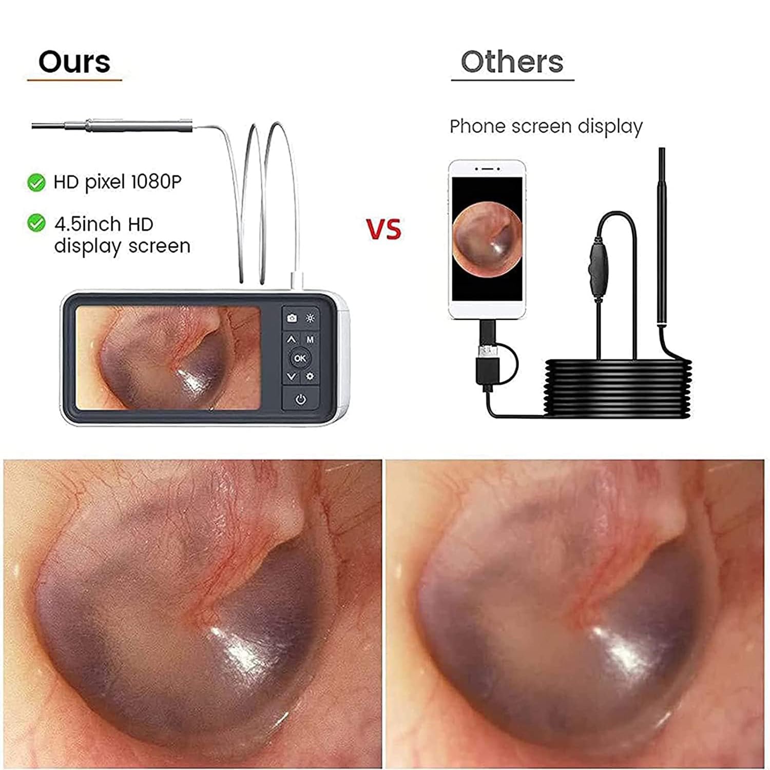 Otoscopio Digital Con Lente De 3.9mm, Pantalla De 4.5 Pulgadas Y 6 Luces LED Ajustables, Batería Recargable De 2500mAh, Con Función Fotográfica, Cámara De Cerumen Para Adultos, Niños Y Mascotas
