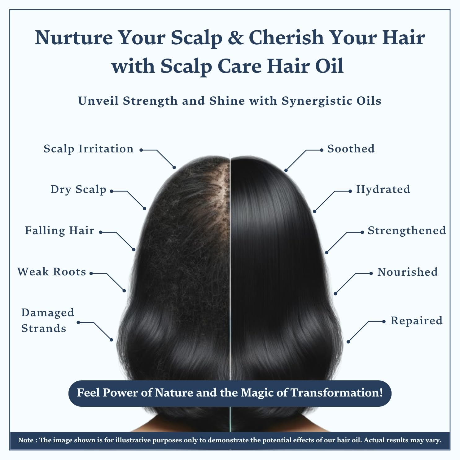 Itchi scalp, soothing and singular scalp care hair oil for control and sebum control, cold -stored, neem, argon and more - 100 ml with tea tree Itchi scalp, soothing and singular scalp care hair oil for control and sebum control, cold -stored, neem, argon and more - 100 ml with tea tree