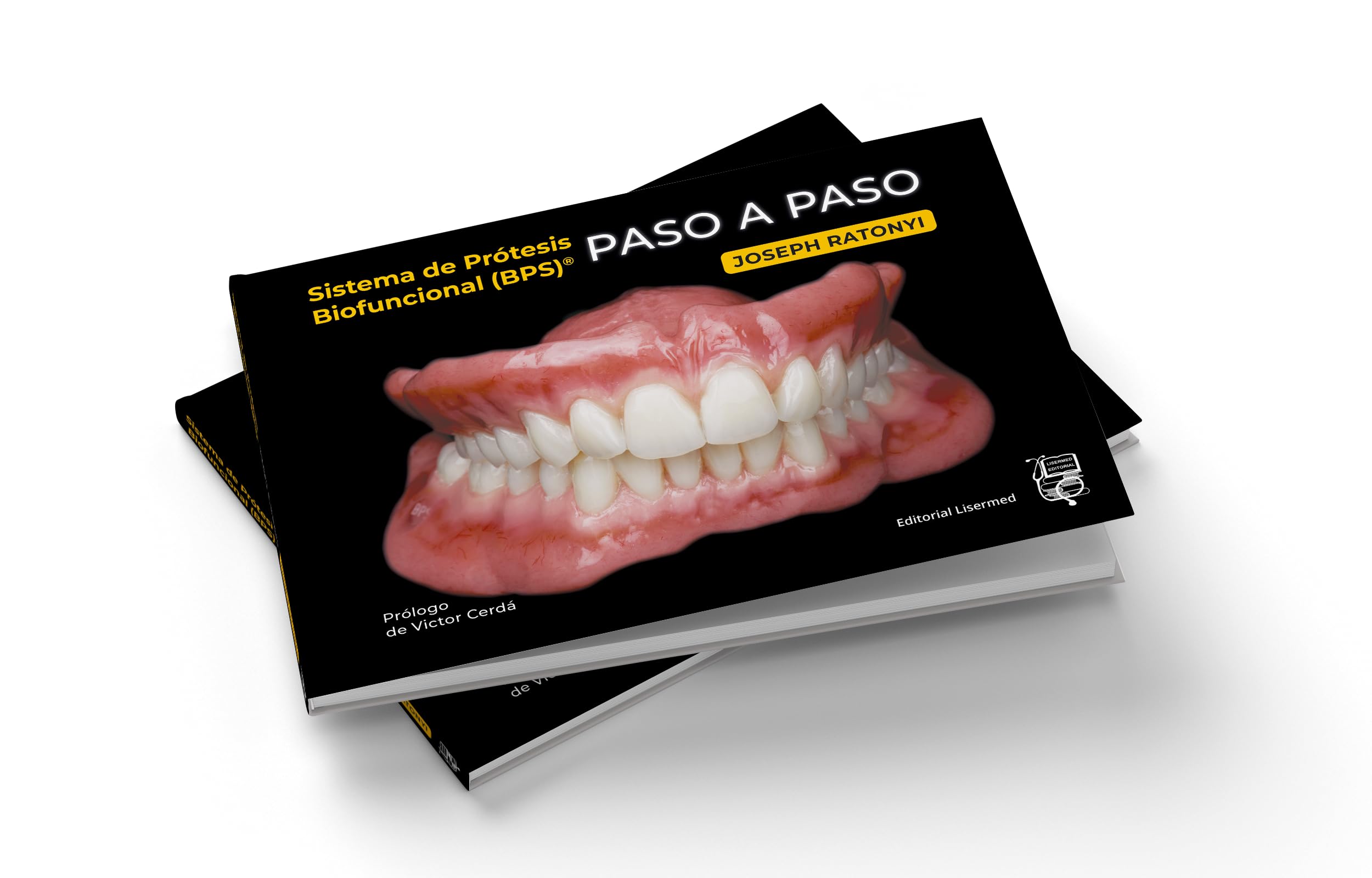 Sistema de Prótesis Biofuncional (BPS) Paso a Paso