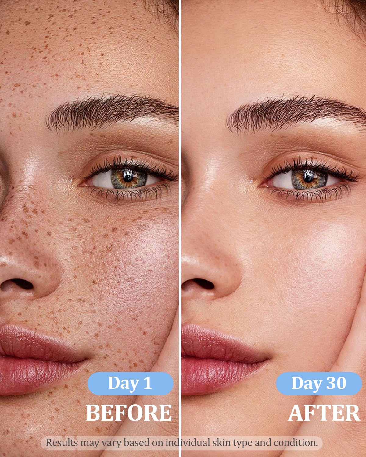 Dark Spot Remover for Face and Body: Dark Spot Corrector Cream, Melasma, Freckle, Sun Spot, Age Spot Remover with Niacinamide and Tranexamic Acid, Natural Formula for All Skin Types - 1.7 Fl Oz