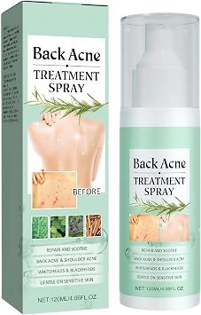 Back Acne Treatment Spray, Back Acne Spray for Backs & Body, Soothes Back-Skin and Moisturizes, 120ml