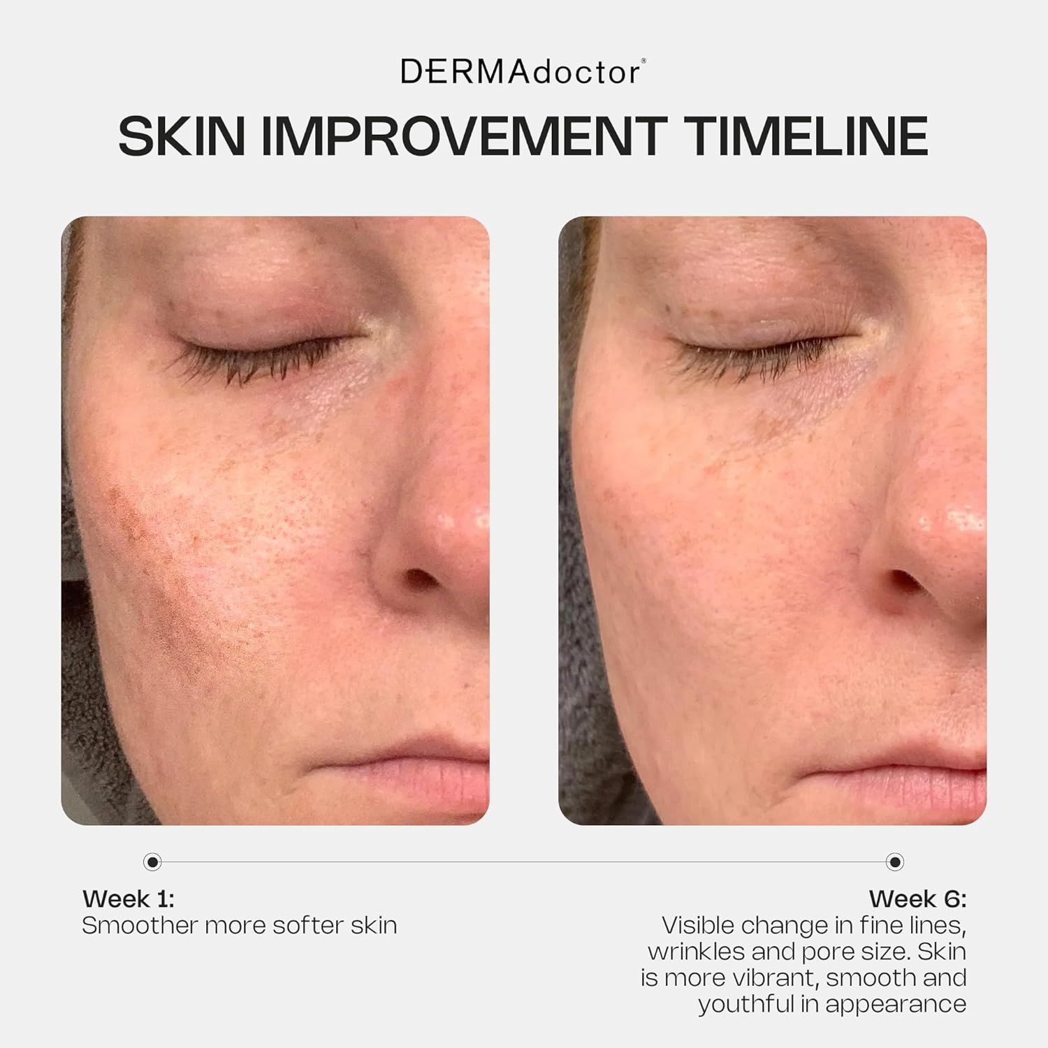 DERMAdoctor Retinol Cream for Face - Stabilized Vitamin C, Vitamin E, Ferulic Acid Anti Aging Face Cream 1% Retinol Facial Moisturizer Night-Cream for Dullness, Discoloration, Fine Lines, & Wrinkles - Image 5