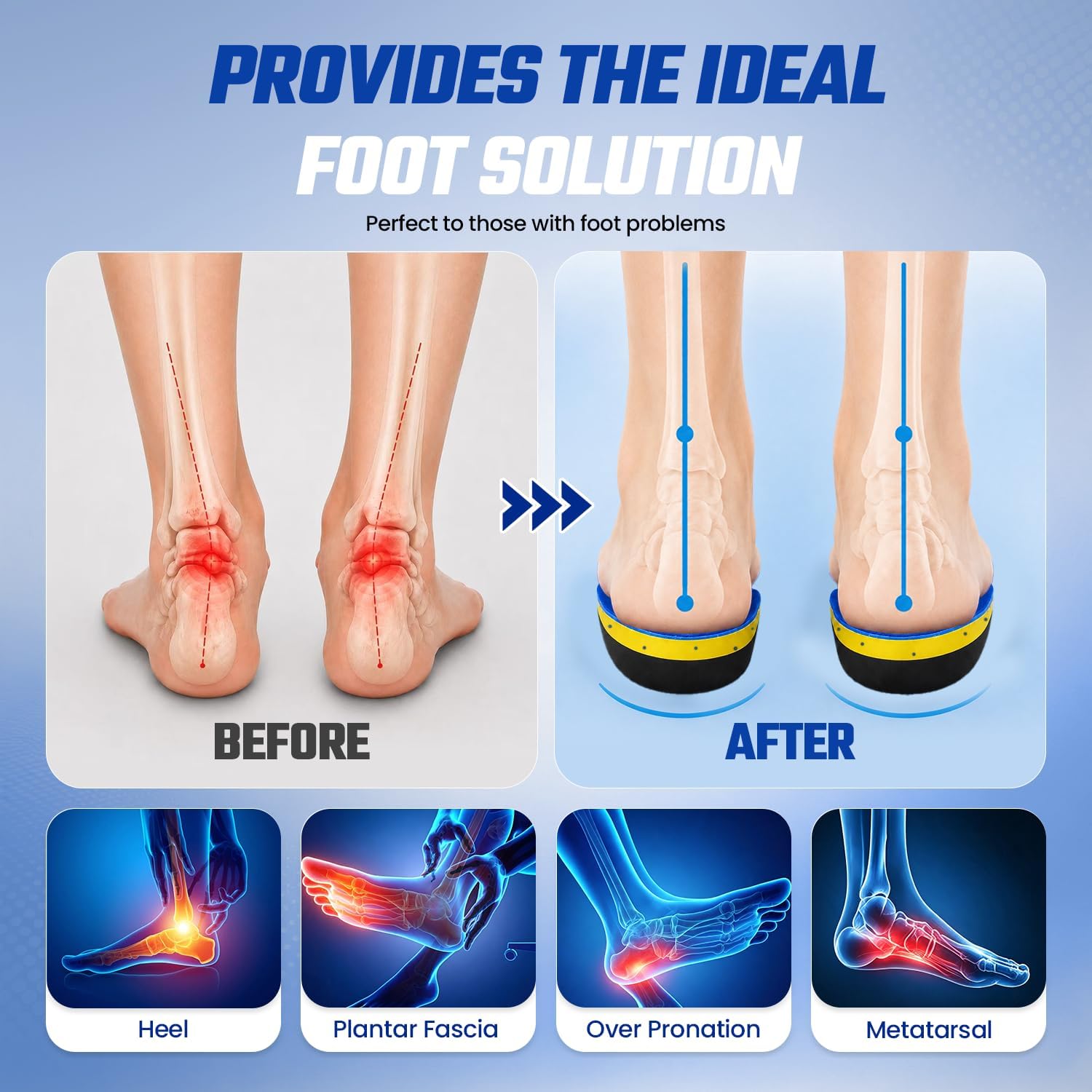 High Arch Support Orthotic Shoe Insoles Insert for Men Women image 4