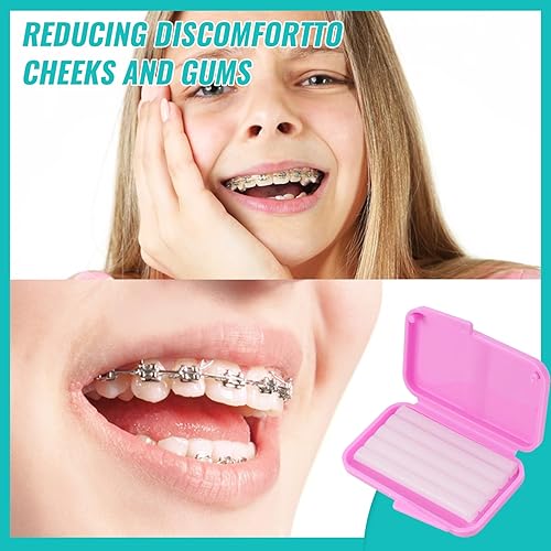 Miniatura 4 de Paquete de 10 soportes dentales de cera para aparatos dentales y alineadores, 50 tiras de cera ortodóntica sin perfume y sin sabor para el cuidado
