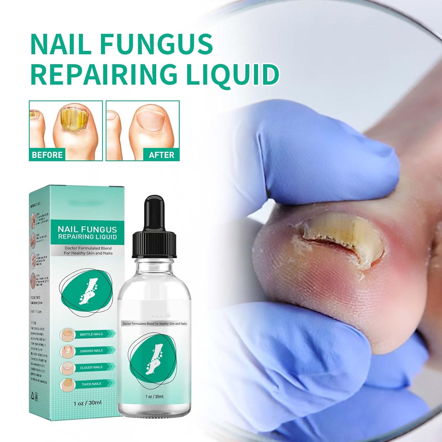 Kerassentials Toenail Fungus Treatment Oil Supports Strong Healthy Natural Repair Nails (1pcs) : Health & Household
