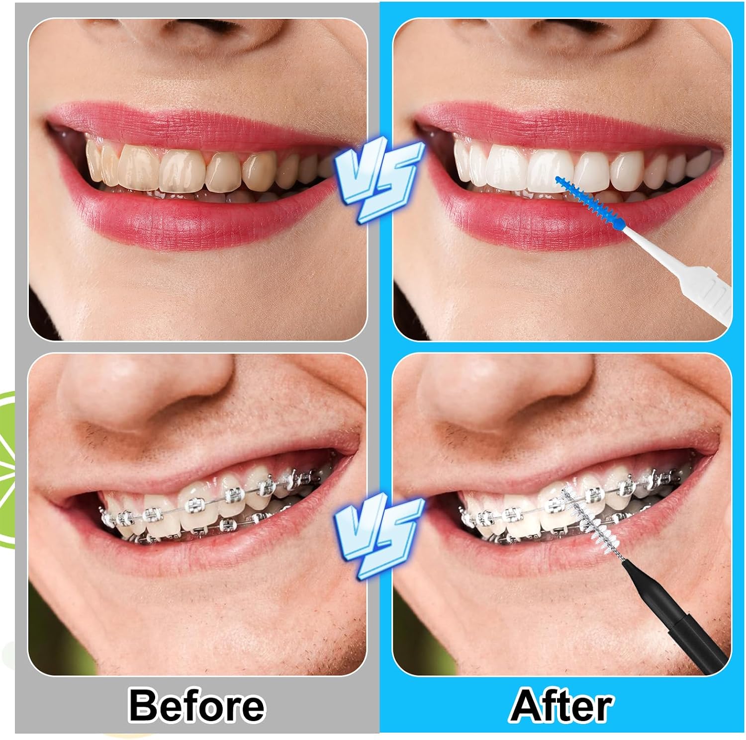 255 Pieces Braces Flossers for Braces, Interdental Brush image 5
