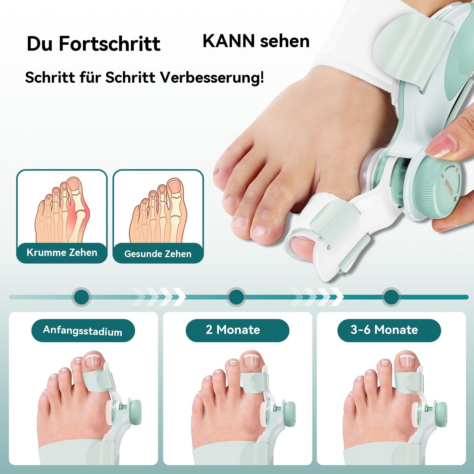 2 Pack Hallux Valgus Korrektur Schiene, Verstellbarer Ballenzeh Korrektor mit Drehknopf für Großzehen-Ausrichtung & Schmerzlinderung, Nacht Hallux Valgus Bandage & Zehenspreizer, Large Band