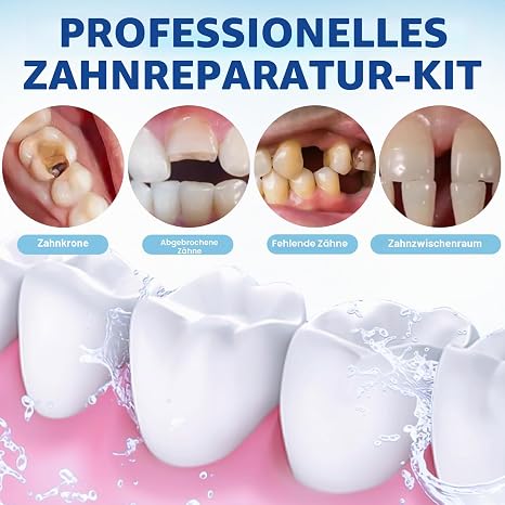 Tooth Filling Repair Kits Temporary Tooth Repair Kit for Broken Teeth and Loose Prostheses Easy Self-Application without Tools Instant Protective Filling 1 Complete Set