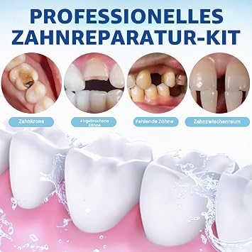Tooth Filling Repair Kits Temporary Tooth Repair Kit for Broken Teeth and Loose Prostheses Easy Self-Application without Tools Instant Protective Filling 1 Complete Set
