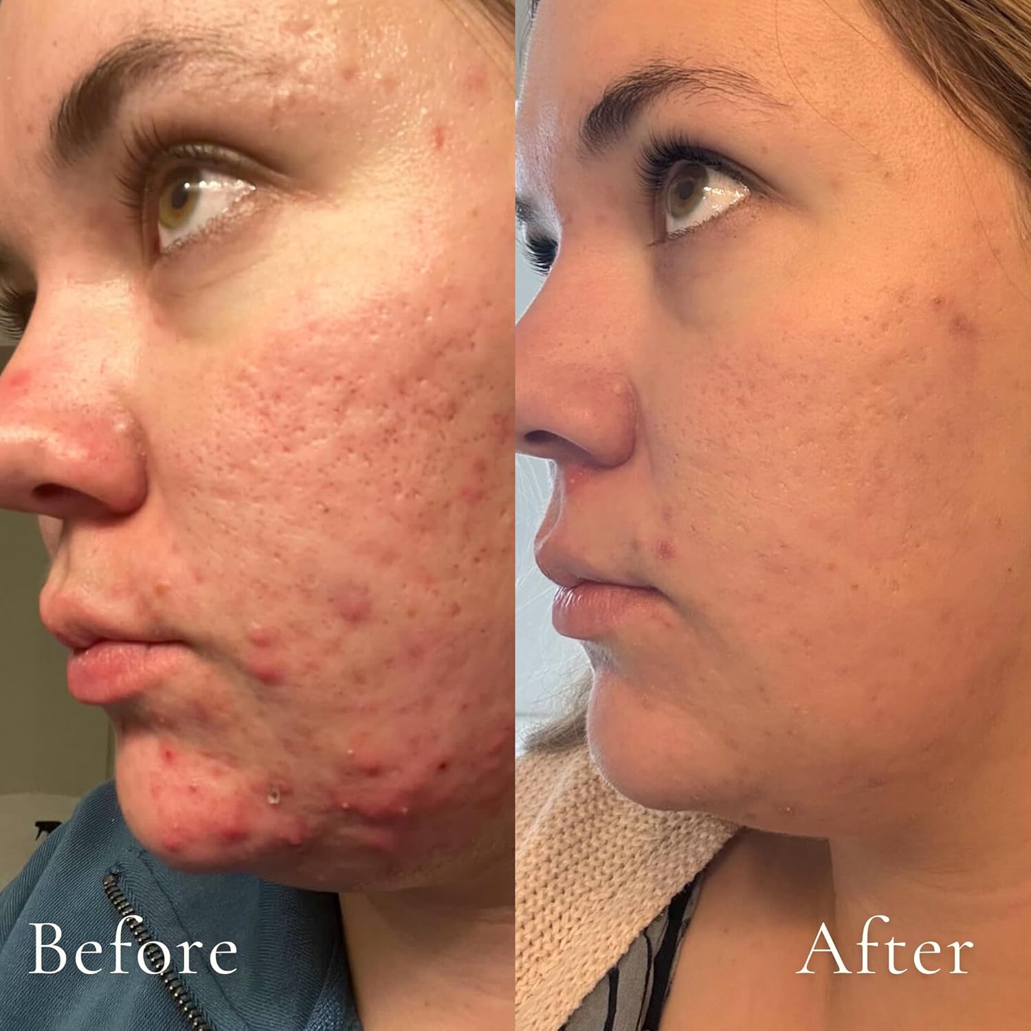 The Daily Essential Jojoba Cleansing Oil For Face Pore Cleaner Non-Toxic + Plant Based | Gentle Deep Cleanser, Makeup Remover, Moisturizing | Cleaner Healthy Skin - Image 3