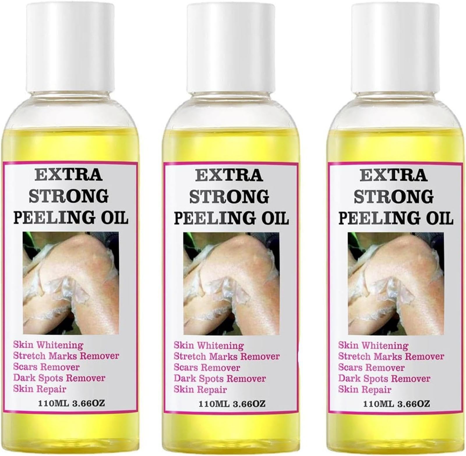 Yellow Peeling Oil,Skin Peeling Exfoliator,Skin Peeling Oil For Skin Lightening, Peeling Oil For Skin Brightening Moisturizing,Peeling Solution Exfoliatings Dark Skin For Body Lightening Bleaching