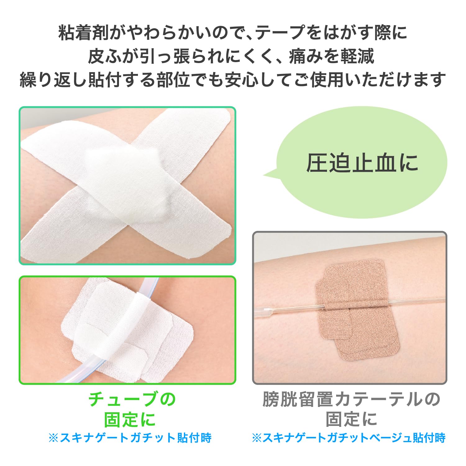 Amazon.co.jp: ニチバン スキナゲート ガチットベージュ 38mm×5m