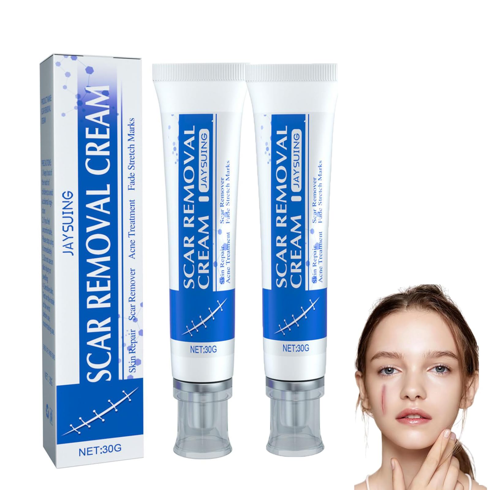 Generisch 2 x Scar Removal Cream, Face & Body Scar Treatment, Promotes Healing & Prevents Scarring