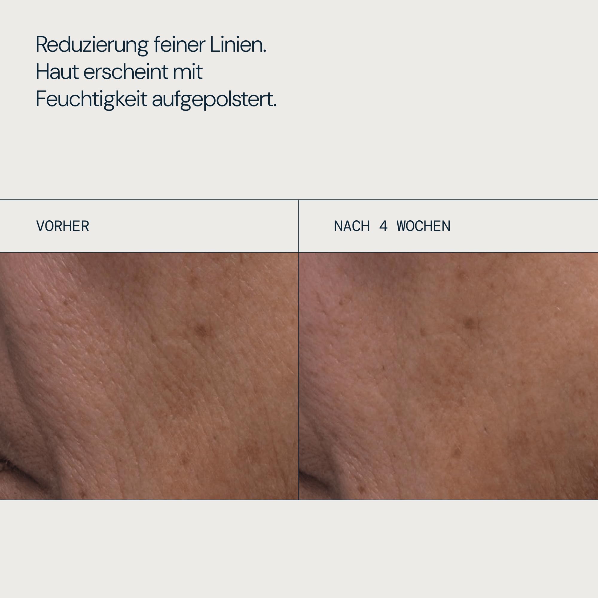 ELEMIS Pro-Collagen Rose Micro Serum 30ml, klinisch bewiesen - Hydrating Anti-Falten Gesichtsserum mit Rosenöl-Extrakt, Anti-Aging Serum zur Stärkung der Hautbarriere