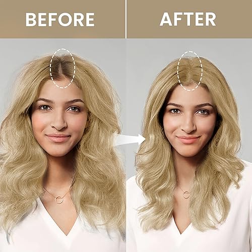 Miniatura 5 de VOLLUCK Polvo de retoque de raíz, polvo instantáneo de línea capilar para áreas de adelgazamiento y cobertura de cabello gris, cubierta de raíces