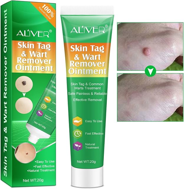 Skin Tag Remover Warts & Mole Remover Cream (20G Cream)