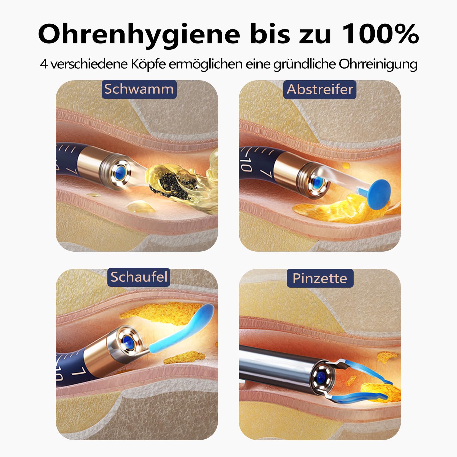 Upgrade Earsight Ohrenschmalz Entfernung Kamera Licht Tool Set, Ohrenreiniger mit flexiblen drahtlosen Otoskop, Painless Visual Pinzette Entferner, tragbare Ohr Reinigung Kit Blua