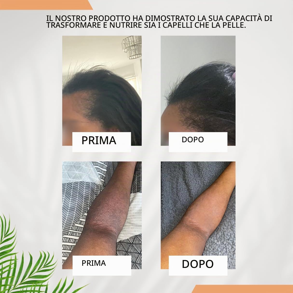 Olio di batana per la crescita dei capelli, 100% puro olio di batana dell'Honduras, per capelli diradati, secchi e danneggiati, certificato autentico, 100 ml
