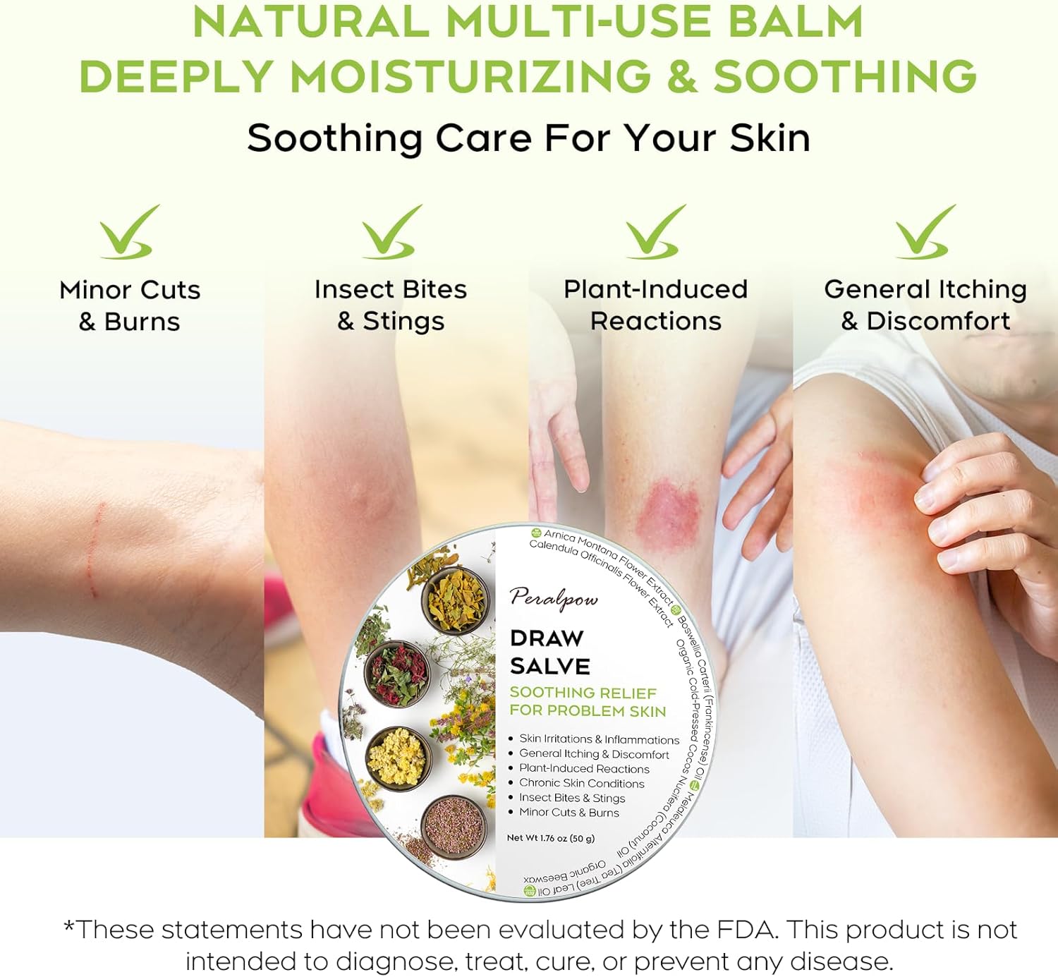 Drawing Salve with Natural Herbal Extracts - Relief for Skin Irritations - Insect Bites & Minor Skin Issues, 1.76 oz - Image 3