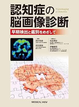 画像で究める認知症診断 画像で究める認知症 | 德丸 阿耶 |本 | 通販 | Amazon
