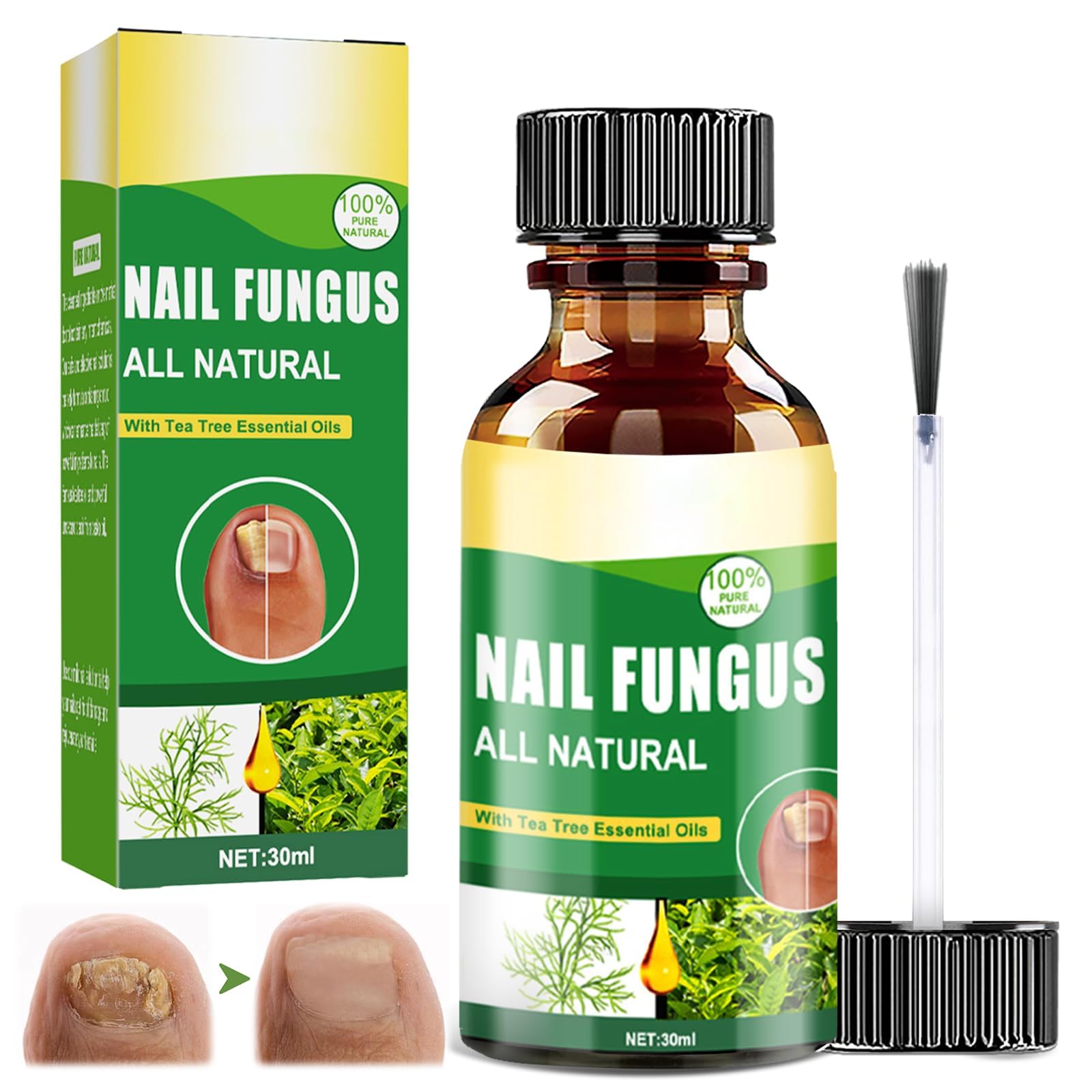 Azonee Nail Strengthening & Repair Oil, Natural Treatment for Brittle Nails, Fast-Acting Nail Care for Fingernails and Toenails, Restores Damaged Nails and Promotes Healthy Growth (30ml)