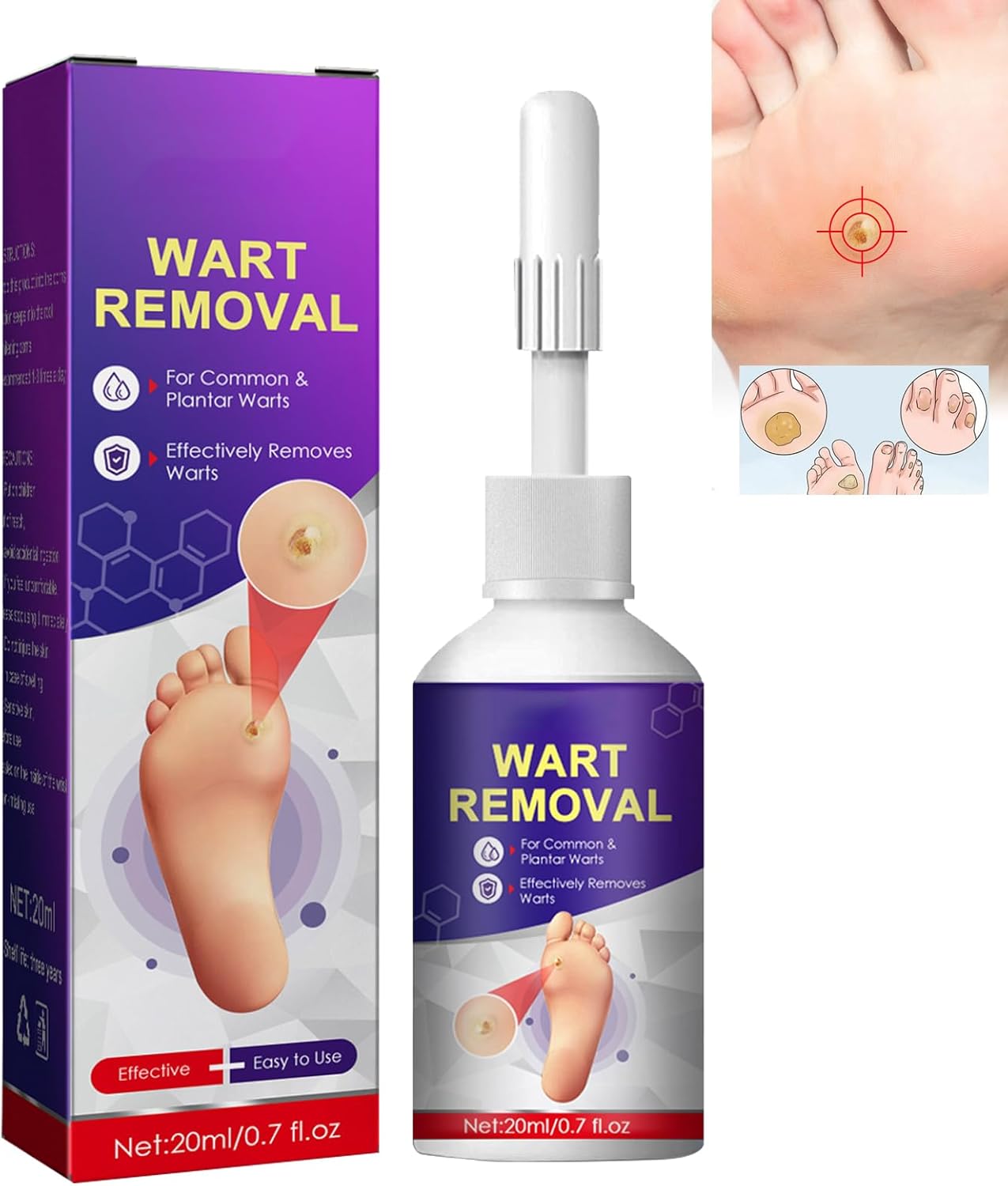 Corn Removal Liquid,Corn Remover for Feet,Corn Callus Remover for Feet
