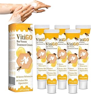 Fivfivgo Beevenom Vitiligo Treatment Cream, Bee Venom Treatment for Vitiligo, Beevenom Vitiligo Treatment Cream for All Skin Types, Vitiligo Bee Venom Treatment Cream (5pcs)